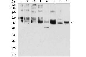 Western blot analysis using CK5 mouse mAb against A431 (1), 3T3-L1 (2), COS7 (3), MCF-7 (4), SK-Br-3 (5), Hela (6), Lncap (7), and HepG2 (8) cell lysate. (Cytokeratin 5 antibody  (AA 258-357))