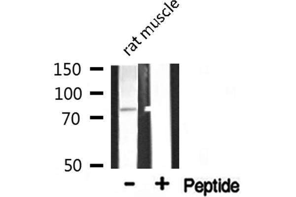 ADD3 antibody  (Internal Region)