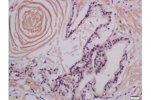 LMAN1 antibody  (AA 31-130)
