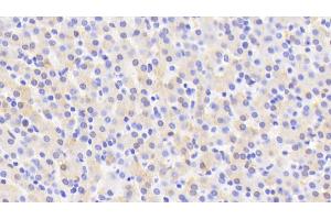 Detection of CYP2D6 in Human Liver Tissue using Polyclonal Antibody to Cytochrome P450 2D6 (CYP2D6) (CYP2D6 antibody  (AA 236-472))