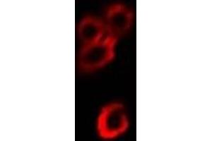 Immunofluorescent analysis of Alpha-enolase staining in Hela cells. (ENO1 antibody)