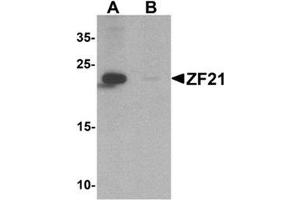 Western blot analysis of ZF21 in 3T3 cell tissue lysate with ZF21 Antibody  at 1 µg/ml in (A) the absence and (B) the presence of blocking peptide. (ZFYVE21 antibody  (N-Term))