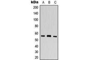 Western blot analysis of PLXDC1 expression in HEK293T (A), Raw264. (PLXDC1 antibody  (Center))