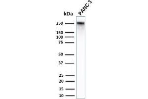 Western Blot Analysis of Human PANC-1 cell lysates using Spectrin Beta 3 Rabbit Monoclonal Antibody (SPTBN2/2979R). (Recombinant Spectrin, Beta, Non-erythrocytic 2 (SPTBN2) (AA 356-475) antibody)