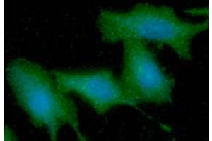 ICC/IF analysis of KRT5 in A549 cells line, stained with DAPI (Blue) for nucleus staining and monoclonal anti-human KRT5 antibody (1:100) with goat anti-mouse IgG-Alexa fluor 488 conjugate (Green). (Cytokeratin 5 antibody  (AA 1-590))