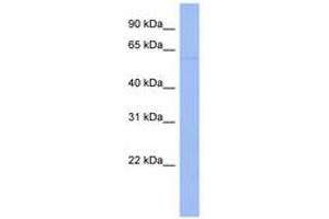 Image no. 1 for anti-E3 Ubiquitin-protein ligase DTX1 (DTX1) (AA 35-84) antibody (ABIN6742771) (Deltex Homolog 1 antibody  (AA 35-84))