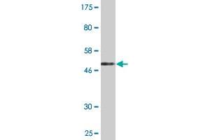 Western Blotting (WB) image for anti-Phosphomevalonate Kinase (PMVK) (AA 1-192) antibody (ABIN524094)