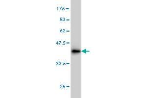 Western Blot detection against Immunogen (36. (DAZ1 antibody  (AA 21-120))