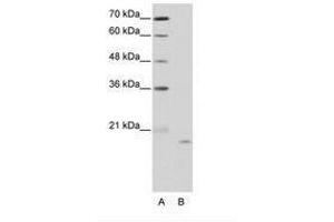 Image no. 1 for anti-Nucleolar Protein 6 (NOL6) (C-Term) antibody (ABIN203026) (Nucleolar Protein 6 antibody  (C-Term))