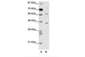 Image no. 1 for anti-TRM1 tRNA Methyltransferase 1-Like (TRMT1L) (AA 61-110) antibody (ABIN6736084) (TRMT1L antibody  (AA 61-110))