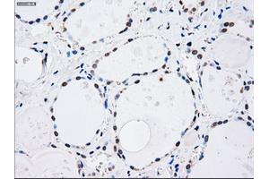 Immunohistochemical staining of paraffin-embedded lung tissue using anti-MAP2K4mouse monoclonal antibody. (MAP2K4 antibody)