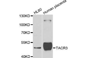 Western blot analysis of extracts of various cell lines, using TACR3 antibody (ABIN5975101) at 1/1000 dilution. (TACR3 antibody)