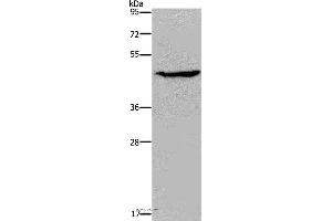 Western blot analysis of K562 cell, using ACP6 Polyclonal Antibody at dilution of 1:200 (ACP6 antibody)
