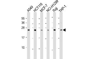 All lanes : Anti-TPD52 Antibody (C-Term) at 1:2000 dilution Lane 1: A549 whole cell lysate Lane 2: HC whole cell lysate Lane 3: MCF-7 whole cell lysate Lane 4: NCI- whole cell lysate Lane 5: Raji whole cell lysate Lane 6: THP-1 whole cell lysate Lysates/proteins at 20 μg per lane. (TPD52 antibody  (AA 193-223))