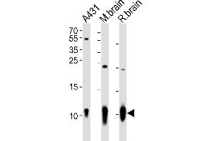 Western blot analysis of lysates from A431 cell line, mouse brain, rat brain tissue (from left to right), using S100B Antibody (ABIN651265 and ABIN2840160). (S100B antibody)