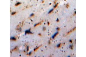 Used in DAB staining on fromalin fixed paraffin-embedded Brain tissue (HSP27 antibody  (AA 2-205))