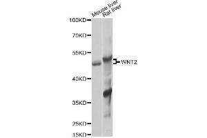 Western blot analysis of extracts of various cell lines, using WNT2 Antibody (ABIN6292350) at 1:1000 dilution. (WNT2 antibody)