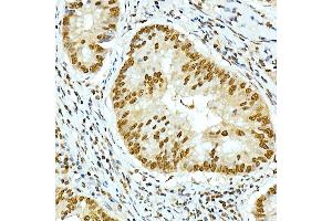 Immunohistochemistry (IHC) image for anti-Interferon alpha/beta Receptor 1 (IFNAR1) (AA 470-557) antibody (ABIN7267947)