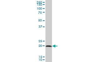 CAPS MaxPab polyclonal antibody. (Calcyphosine antibody  (AA 1-189))