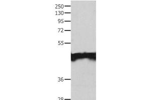 Western Blot analysis of Jurkat cell using MAT1A Polyclonal Antibody at dilution of 1:200 (MAT1A antibody)