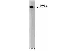 Western blot analysis of PI3-Kinase p170 on rat brain lysate. (PI3-Kinase p170 antibody)