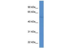 Image no. 1 for anti-Ets Variant 1 (ETV1) (AA 69-118) antibody (ABIN6746035) (ETV1 antibody  (AA 69-118))