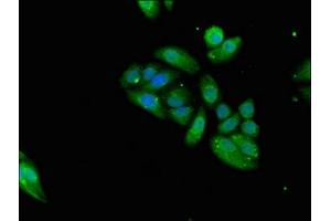 Immunofluorescent analysis of HepG2 cells using ABIN7161085 at dilution of 1:100 and Alexa Fluor 488-congugated AffiniPure Goat Anti-Rabbit IgG(H+L) (CD94 antibody  (AA 42-168))