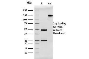 SDS-PAGE Analysis Purified MUC2 Recombinant Mouse Monoclonal Antibody (rMLP/842). (Recombinant MUC2 antibody)