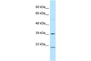 WB Suggested Anti-MPZL3 Antibody Titration: 1. (MPZL3 antibody  (C-Term))