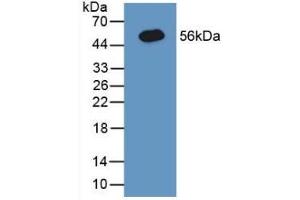 Detection of Recombinant CNX, Human using Polyclonal Antibody to Calnexin (CNX) (Calnexin antibody  (AA 239-461))