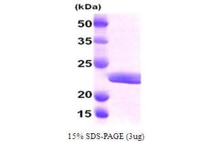 SDS-PAGE (SDS) image for Myosin, Light Chain 2, Regulatory, Cardiac, Slow (MYL2) (AA 1-166) protein (His tag) (ABIN667089) (MYL2 Protein (AA 1-166) (His tag))