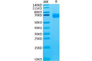 Cynomolgus LILRA4/CD85g on Tris-Bis PAGE under reduced condition. (LILRA4 Protein (AA 24-446) (His tag))