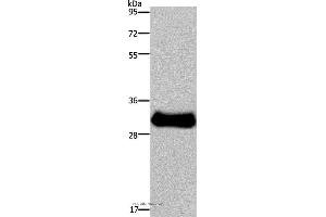 Western blot analysis of Mouse skeletal muscle tissue, using FHL3 Polyclonal Antibody at dilution of 1:1600 (FHL3 antibody)