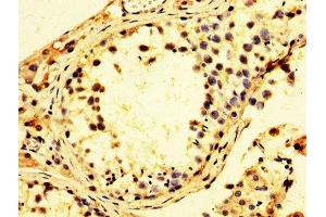 Immunohistochemistry of paraffin-embedded human testis tissue using ABIN7142230 at dilution of 1:100 (PSMC3 antibody  (Regulatory Subunit 6A))