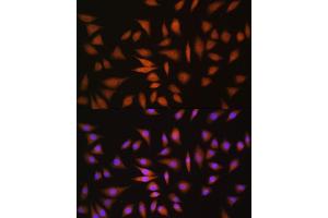 Immunofluorescence analysis of L929 cells using NRBF2 antibody  at dilution of 1:100.