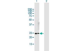 Western Blot analysis of NMNAT3 expression in transfected 293T cell line by NMNAT3 MaxPab polyclonal antibody.