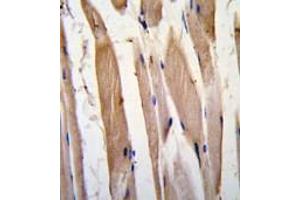 Formalin-fixed and paraffin-embedded human skeletal muscle tissue reacted with VINC antibody (N-term) , which was peroxidase-conjugated to the secondary antibody, followed by DAB staining. (Vinculin antibody  (N-Term))