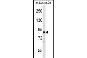 Western blot analysis in mouse Neuro-2a cell line lysates (35ug/lane). (ZDHHC8 antibody  (C-Term))