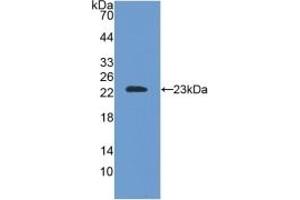 Detection of Recombinant SOD2, Mouse using Polyclonal Antibody to Superoxide Dismutase 2, Mitochondrial (SOD2) (SOD2 antibody  (AA 25-222))