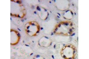 Used in DAB staining on fromalin fixed paraffin-embedded kidney tissue (TREH antibody  (AA 151-411))