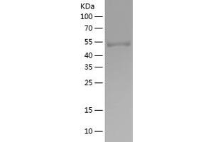 Western Blotting (WB) image for Synaptotagmin I (SYT1) (AA 1-220) protein (His-IF2DI Tag) (ABIN7281923) (SYT1 Protein (AA 1-220) (His-IF2DI Tag))