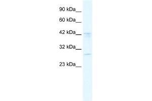 WB Suggested Anti-BRD9 Antibody Titration:  2. (BRD9 antibody  (N-Term))