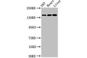 Western Blot Positive WB detected in: U87 whole cell lysate, Rat heart tissue, Mouse liver tissue All lanes: GRIN2A antibody at 3. (NMDAR2A antibody  (AA 501-750))