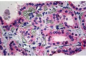 Human Thyroid: Formalin-Fixed, Paraffin-Embedded (FFPE) (CD51 antibody  (Cleaved-Lys889))