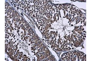 IHC-P Image Wilms Tumor 1 antibody detects Wilms Tumor 1 protein at cytoplasm in mouse testis by immunohistochemical analysis.