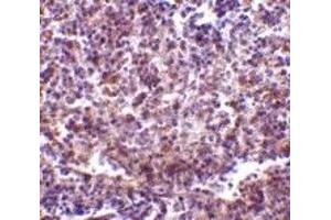 Immunohistochemistry (IHC) image for anti-CD180 Molecule (CD180) (N-Term) antibody (ABIN1031545) (CD180 antibody  (N-Term))