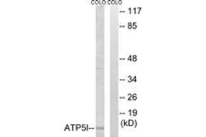 Western blot analysis of extracts from COLO cells, using ATP5I Antibody. (ATP5I antibody  (AA 20-69))