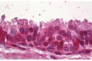Anti-ZNF217 antibody IHC staining of human prostate.