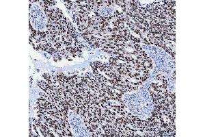 IHC analysis of FEN1 using anti-FEN1 antibody (ABIN7601617).