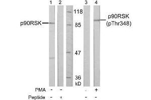 Image no. 3 for anti-Ribosomal Protein S6 Kinase, 90kDa, Polypeptide 1 (RPS6KA1) (pThr348) antibody (ABIN196797) (RPS6KA1 antibody  (pThr348))
